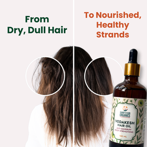 Vedakesh Hair Oil - 100 ml